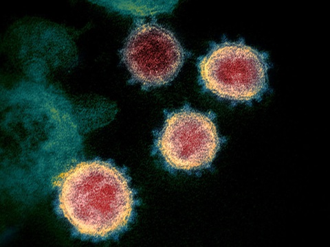 Nghiên cứu khoa học giải đáp hai câu hỏi quan trọng về miễn dịch với virus SARS-COV-2 - Ảnh 1. Nghiên cứu khoa học giải đáp hai câu hỏi quan trọng về miễn dịch với virus SARS-COV-2 - Ảnh 1.