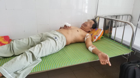 Tranh cãi vì tiếng nẹt pô, ông thương binh già bị hàng xóm chém trọng thương - Ảnh 1. Tranh cãi vì tiếng nẹt pô, ông thương binh già bị hàng xóm chém trọng thương - Ảnh 1.