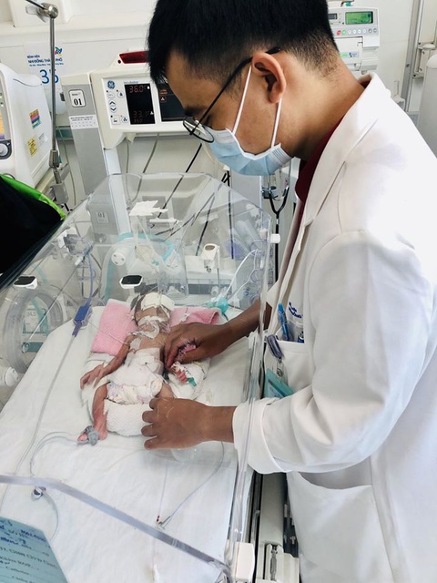 Mổ cứu sống trẻ sinh non, nhẹ ký bị tắc ruột ngay khi rời bụng mẹ - Ảnh 1. Mổ cứu sống trẻ sinh non, nhẹ ký bị tắc ruột ngay khi rời bụng mẹ - Ảnh 1.