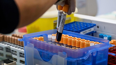 Phát hiện mới: Người nhóm máu O có sức đề kháng tốt hơn với virus corona - Ảnh 1. Phát hiện mới: Người nhóm máu O có sức đề kháng tốt hơn với virus corona - Ảnh 1.