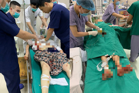 Người đàn ông truy sát vợ, bố vợ và em vợ rồi treo cổ tự tử - Ảnh 1. Người đàn ông truy sát vợ, bố vợ và em vợ rồi treo cổ tự tử - Ảnh 1.
