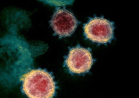 Tìm thấy xúc tu nguy hiểm trong cấu tạo của virus gây COVID-19 - Ảnh 1. Tìm thấy xúc tu nguy hiểm trong cấu tạo của virus gây COVID-19 - Ảnh 1.
