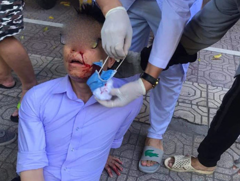 Vợ nguyên chủ tịch phường thuê côn đồ đánh người tố cáo: Không thể chấp nhận! - Ảnh 1. Vợ nguyên chủ tịch phường thuê côn đồ đánh người tố cáo: Không thể chấp nhận! - Ảnh 1.