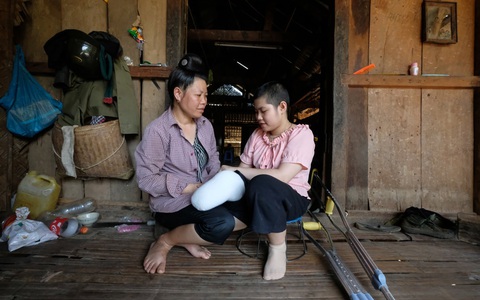 Thấy con đi tập tễnh, đau lắm - Ảnh 1. Thấy con đi tập tễnh, đau lắm - Ảnh 1.