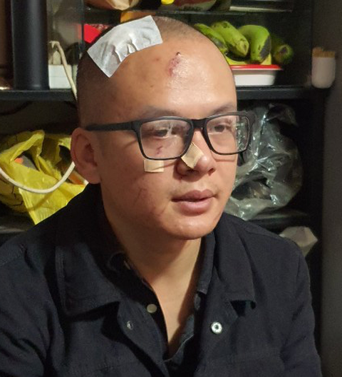 Người đăng ảnh chê khu du lịch Quỷ Núi bị đánh hội đồng tại quán cà phê - Ảnh 4. Người đăng ảnh chê khu du lịch Quỷ Núi bị đánh hội đồng tại quán cà phê - Ảnh 4.