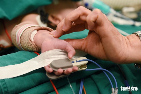 Trúc Nhi - Diệu Nhi ổn định sau mổ, được tái tạo đường tiêu hóa, niệu đạo sau 3 tháng - Ảnh 1. Trúc Nhi - Diệu Nhi ổn định sau mổ, được tái tạo đường tiêu hóa, niệu đạo sau 3 tháng - Ảnh 1.