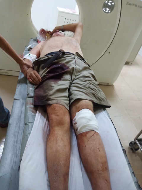 Ông tây ‘cực ngầu’ chặn xe ngược chiều hôm trước, hôm sau bị tai nạn - Ảnh 3. Ông tây ‘cực ngầu’ chặn xe ngược chiều hôm trước, hôm sau bị tai nạn - Ảnh 3.