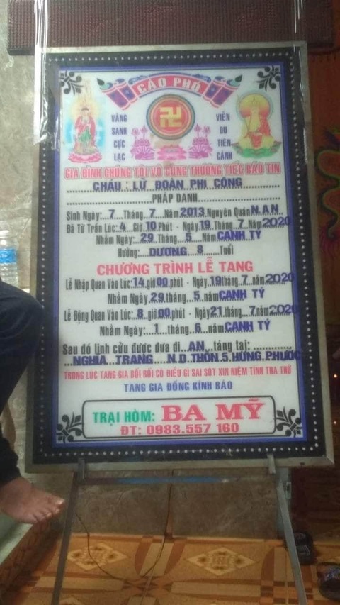 Trước khi mổ lấy đinh nẹp ở tay, sức khỏe cháu Công bình thường - Ảnh 2. Trước khi mổ lấy đinh nẹp ở tay, sức khỏe cháu Công bình thường - Ảnh 2.