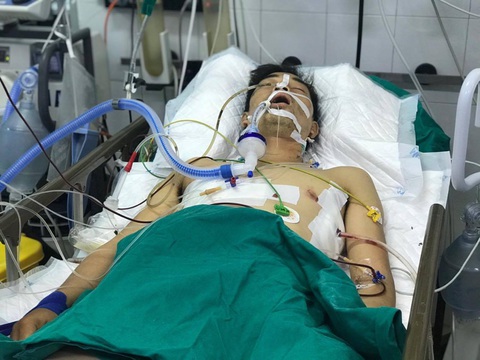 Cứu tài xế xe ôm bị cướp đâm vào ngực, sườn, lưng cướp xe, 20 phút sau mới tới được bệnh viện - Ảnh 1. Cứu tài xế xe ôm bị cướp đâm vào ngực, sườn, lưng cướp xe, 20 phút sau mới tới được bệnh viện - Ảnh 1.