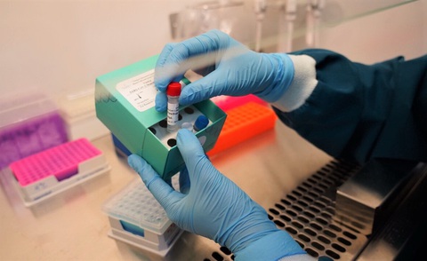 Vinmec phát triển thành công 2 bộ kit xét nghiệm virus corona - Ảnh 1. Vinmec phát triển thành công 2 bộ kit xét nghiệm virus corona - Ảnh 1.