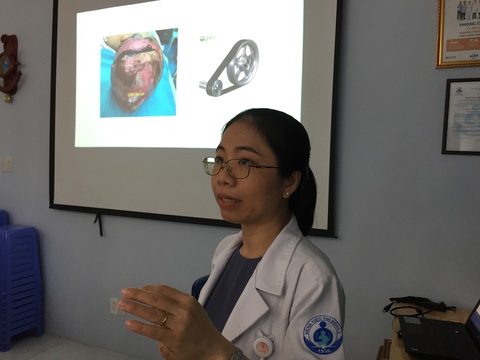 Ghép da đầu cho bé gái bị máy cưa nước đá lột gần nửa diện tích da đầu - Ảnh 1. Ghép da đầu cho bé gái bị máy cưa nước đá lột gần nửa diện tích da đầu - Ảnh 1.