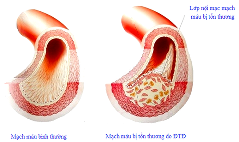 Biện pháp bảo vệ người tiểu đường trước đại dịch - Ảnh 1. Biện pháp bảo vệ người tiểu đường trước đại dịch - Ảnh 1.