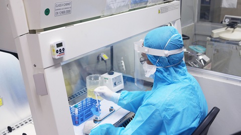 Dùng cách xét nghiệm nhanh với khuẩn lao cho virus corona - Ảnh 1. Dùng cách xét nghiệm nhanh với khuẩn lao cho virus corona - Ảnh 1.