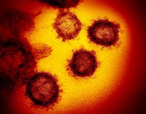 Thụy Sĩ phát hiện virus SARS-CoV-2 trong da người - Ảnh 1. Thụy Sĩ phát hiện virus SARS-CoV-2 trong da người - Ảnh 1.