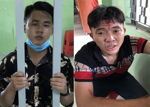 Một thượng úy công an bị đâm nhập viện trong lúc bắt trộm - Ảnh 1. Một thượng úy công an bị đâm nhập viện trong lúc bắt trộm - Ảnh 1.