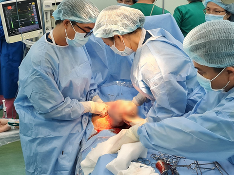 Cứu sống một bé gái có khối u khổng lổ trên mặt lúc chào đời - Ảnh 2. Cứu sống một bé gái có khối u khổng lổ trên mặt lúc chào đời - Ảnh 2.