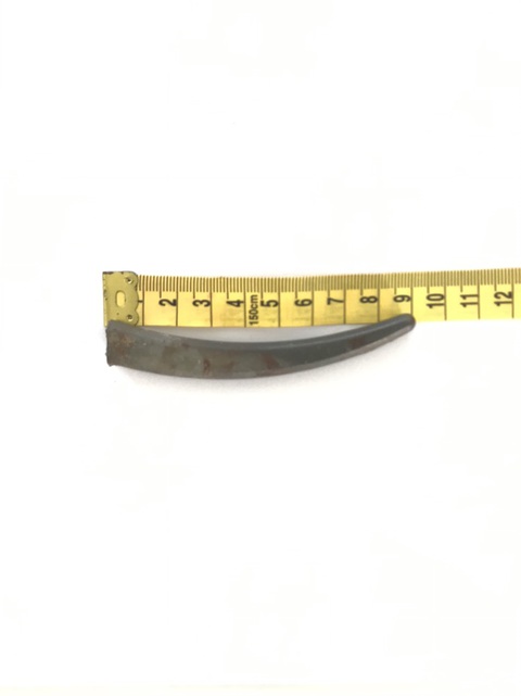 Cấp cứu thành công thí sinh bị dị vật dài 9cm đâm xuyên hốc mắt - Ảnh 2. Cấp cứu thành công thí sinh bị dị vật dài 9cm đâm xuyên hốc mắt - Ảnh 2.