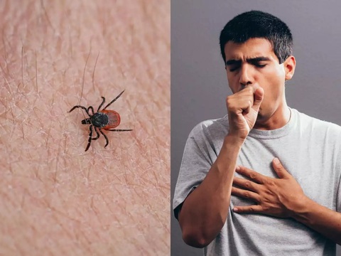 Virus lây từ bọ ve cắn làm 7 người chết, 60 người nhiễm bệnh tại Trung Quốc - Ảnh 1. Virus lây từ bọ ve cắn làm 7 người chết, 60 người nhiễm bệnh tại Trung Quốc - Ảnh 1.