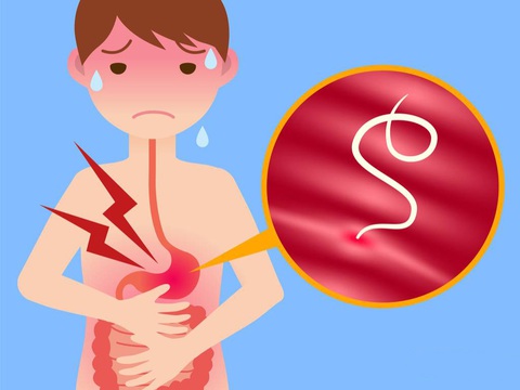 Lợi ích bất ngờ của việc tẩy giun thường xuyên cho trẻ em - Ảnh 1. Lợi ích bất ngờ của việc tẩy giun thường xuyên cho trẻ em - Ảnh 1.