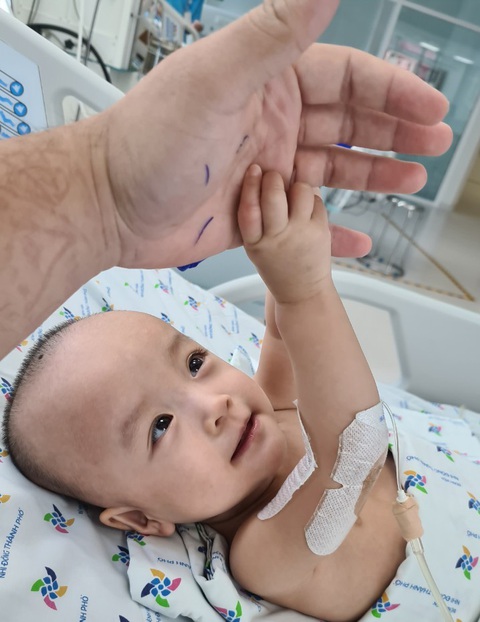 Trúc Nhi - Diệu Nhi sẽ tập đi trong 6 tuần tới - Ảnh 1. Trúc Nhi - Diệu Nhi sẽ tập đi trong 6 tuần tới - Ảnh 1.