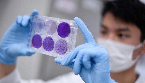 Bệnh nhân COVID-19 bị choáng là do virus tấn công lên não rồi tự nhân bản - Ảnh 1. Bệnh nhân COVID-19 bị choáng là do virus tấn công lên não rồi tự nhân bản - Ảnh 1.