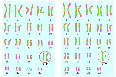 Bí mật của COVID-19: Đã có bão cytokine lại còn thêm bão bradykinin - Ảnh 3. Bí mật của COVID-19: Đã có bão cytokine lại còn thêm bão bradykinin - Ảnh 3.
