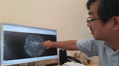 Bé 3 tuổi bị đột quỵ, người lớn không tin nổi - Ảnh 1. Bé 3 tuổi bị đột quỵ, người lớn không tin nổi - Ảnh 1.