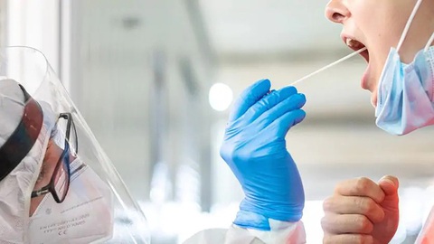 Xét nghiệm tìm virus corona qua nước bọt đáng tin cậy không? - Ảnh 1. Xét nghiệm tìm virus corona qua nước bọt đáng tin cậy không? - Ảnh 1.