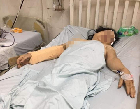 Điều tra vụ người đàn ông dùng thanh gỗ đánh vợ cũ dã man - Ảnh 2. Điều tra vụ người đàn ông dùng thanh gỗ đánh vợ cũ dã man - Ảnh 2.