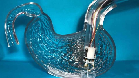 Điều trị tổn thương thành dạ dày bằng công nghệ in 3D sinh học - Ảnh 1. Điều trị tổn thương thành dạ dày bằng công nghệ in 3D sinh học - Ảnh 1.