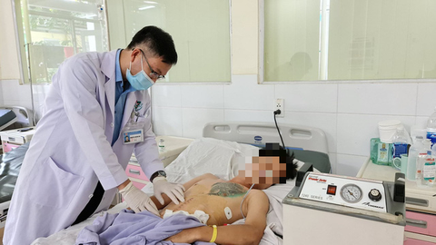Nam thanh niên nuốt vào bụng cả ký đinh, thìa, lưỡi dao, bấm móng tay - Ảnh 3. Nam thanh niên nuốt vào bụng cả ký đinh, thìa, lưỡi dao, bấm móng tay - Ảnh 3.