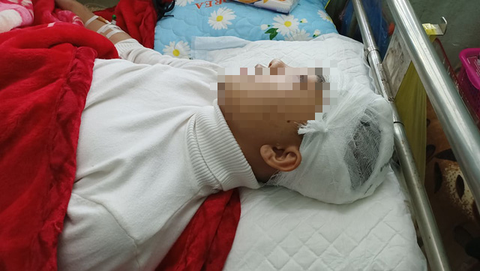 Nam sinh lớp 11 nghi bị bạn cùng trường dùng gậy sắt đánh chấn thương sọ não - Ảnh 1. Nam sinh lớp 11 nghi bị bạn cùng trường dùng gậy sắt đánh chấn thương sọ não - Ảnh 1.