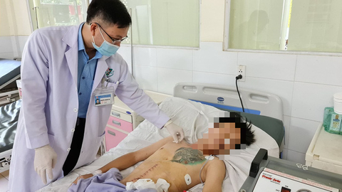 Kinh ngạc khi bệnh nhân nuốt gần 1kg đinh, muỗng, dao... mà bao tử vẫn bình yên - Ảnh 1. Kinh ngạc khi bệnh nhân nuốt gần 1kg đinh, muỗng, dao... mà bao tử vẫn bình yên - Ảnh 1.
