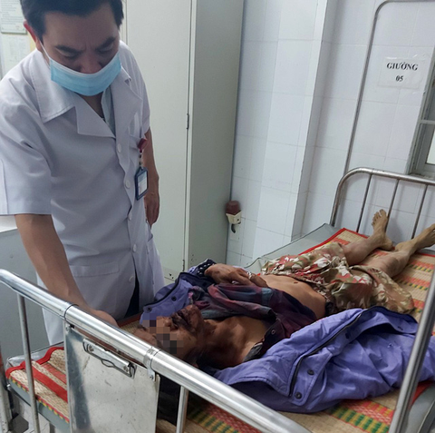 Một người đàn ông chấn thương sọ não nghi bị voi rừng quật - Ảnh 3. Một người đàn ông chấn thương sọ não nghi bị voi rừng quật - Ảnh 3.