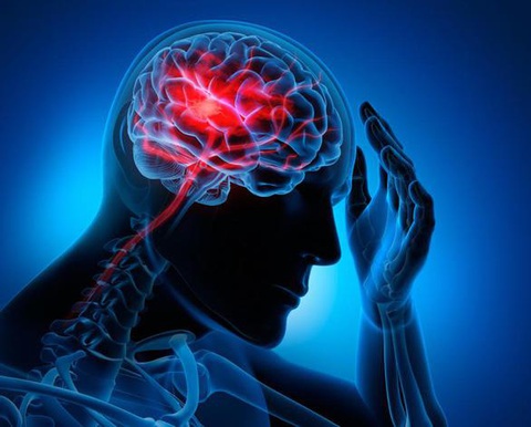 Phục hồi chức năng: bài toán sống còn sau đột quỵ - Ảnh 1. Phục hồi chức năng: bài toán sống còn sau đột quỵ - Ảnh 1.