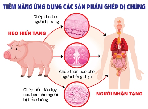 Ghép thành công thận heo cho người: Đột phá khoa học sẽ cứu sống nhiều người? - Ảnh 3. Ghép thành công thận heo cho người: Đột phá khoa học sẽ cứu sống nhiều người? - Ảnh 3.