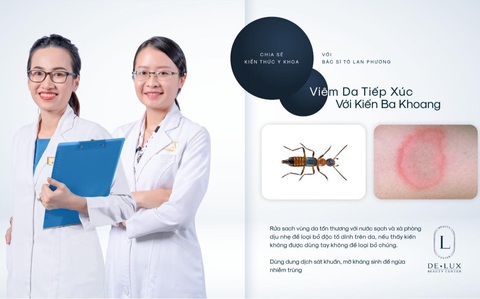 Bác sĩ Tô Lan Phương chia sẻ cách xử trí viêm da tiếp xúc với kiến ba khoang - Ảnh 1. Bác sĩ Tô Lan Phương chia sẻ cách xử trí viêm da tiếp xúc với kiến ba khoang - Ảnh 1.