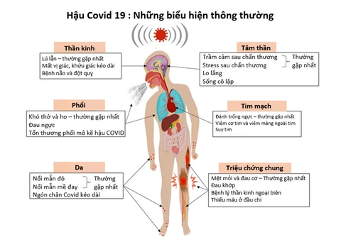 Ai dễ mắc xơ phổi hậu COVID, di chứng này có nguy hiểm không? - Ảnh 1. Ai dễ mắc xơ phổi hậu COVID, di chứng này có nguy hiểm không? - Ảnh 1.