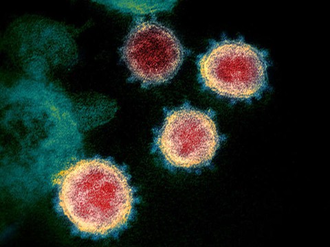 Biến thể virus corona có thể làm giảm hiệu quả vắc xin xuất hiện rồi tuyệt chủng? - Ảnh 1. Biến thể virus corona có thể làm giảm hiệu quả vắc xin xuất hiện rồi tuyệt chủng? - Ảnh 1.
