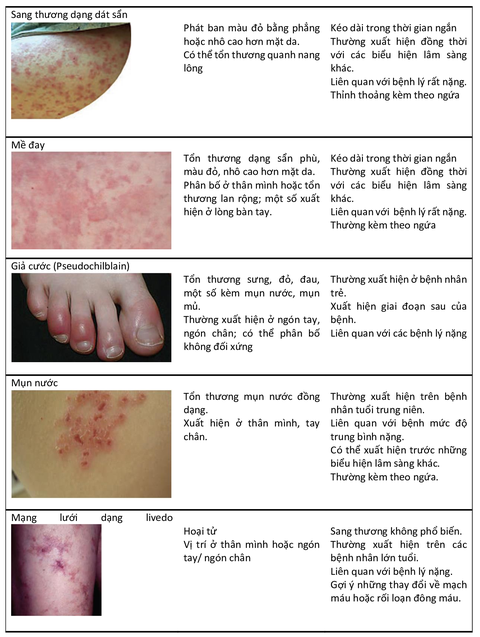 Khoảng 50 triệu chứng hậu COVID: thở gấp, ho, nhức đầu, trầm cảm, và gì nữa? - Ảnh 6. Khoảng 50 triệu chứng hậu COVID: thở gấp, ho, nhức đầu, trầm cảm, và gì nữa? - Ảnh 6.