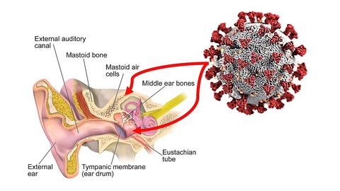 Virus SARS-CoV-2 có thể tấn công tai trong của bệnh nhân - Ảnh 1. Virus SARS-CoV-2 có thể tấn công tai trong của bệnh nhân - Ảnh 1.