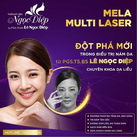 Mela Multi Laser – đột phá mới trong điều trị nám da - Ảnh 1. Mela Multi Laser – đột phá mới trong điều trị nám da - Ảnh 1.