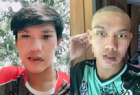 Rụng tóc sau mắc COVID-19, tiêm vắc xin: Tóc mọc lại không? Chuyên gia nói gì? - Ảnh 2. Rụng tóc sau mắc COVID-19, tiêm vắc xin: Tóc mọc lại không? Chuyên gia nói gì? - Ảnh 2.