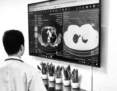 Số bệnh nhân lao được phát hiện giảm hơn 23%: Đừng vội mừng - Ảnh 1. Số bệnh nhân lao được phát hiện giảm hơn 23%: Đừng vội mừng - Ảnh 1.