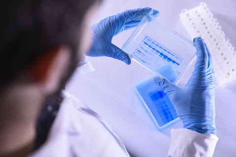 Nhật Bản bào chế thành công vaccine giúp loại bỏ các tế bào lão hóa - Ảnh 1. Nhật Bản bào chế thành công vaccine giúp loại bỏ các tế bào lão hóa - Ảnh 1.