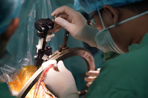 Điều trị bệnh Parkinson hiệu quả bằng phương pháp phẫu thuật kích não sâu - Ảnh 4. Điều trị bệnh Parkinson hiệu quả bằng phương pháp phẫu thuật kích não sâu - Ảnh 4.