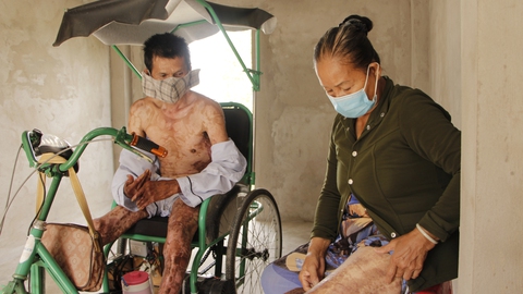 Mẹ nghèo lóc da cứu con - Ảnh 1. Mẹ nghèo lóc da cứu con - Ảnh 1.