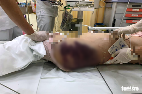 Bắt khẩn cấp ‘dì ghẻ’ bạo hành làm bé gái 8 tuổi tử vong - Ảnh 1. Bắt khẩn cấp ‘dì ghẻ’ bạo hành làm bé gái 8 tuổi tử vong - Ảnh 1.