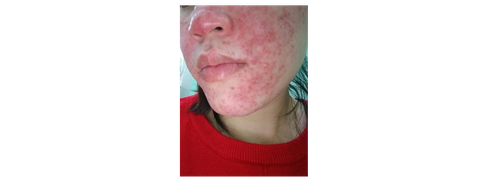 Tạm biệt da xấu nhờ phương pháp phục hồi da tại nhà - Ảnh 1. Tạm biệt da xấu nhờ phương pháp phục hồi da tại nhà - Ảnh 1.