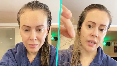 Rụng tóc sau mắc COVID-19, tiêm vắc xin: Tóc mọc lại không? Chuyên gia nói gì? - Ảnh 1. Rụng tóc sau mắc COVID-19, tiêm vắc xin: Tóc mọc lại không? Chuyên gia nói gì? - Ảnh 1.